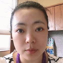 Ling Zhang